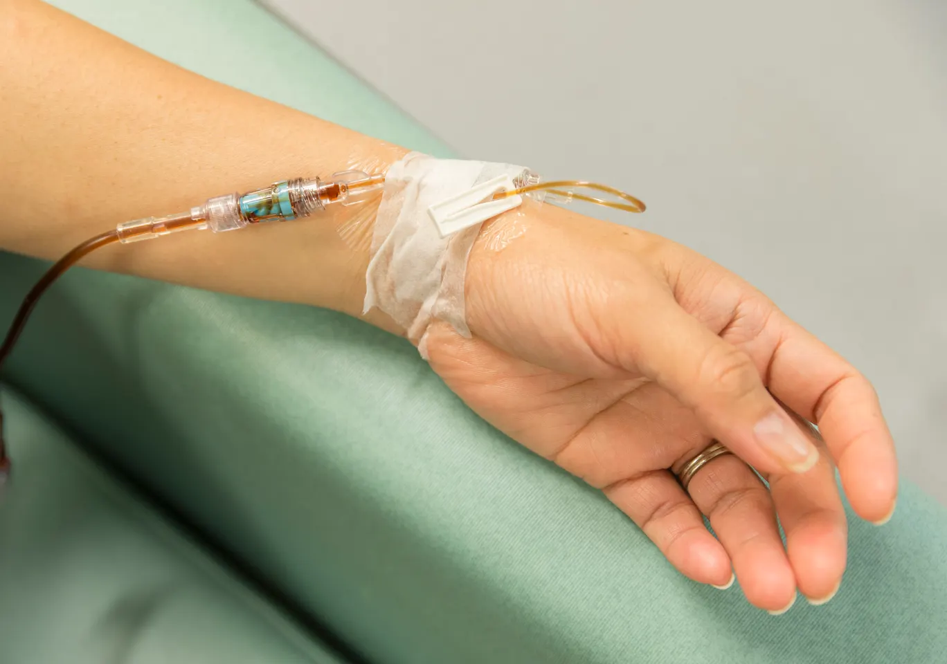 Kroplówki witaminowe Ustroń: dłoń z wenflonem i linią infuzyjną na podkładzie